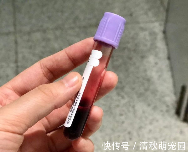 阴超|怀孕多久做B超检查比较好?这份孕早期检查攻略,孕妈们查收学习