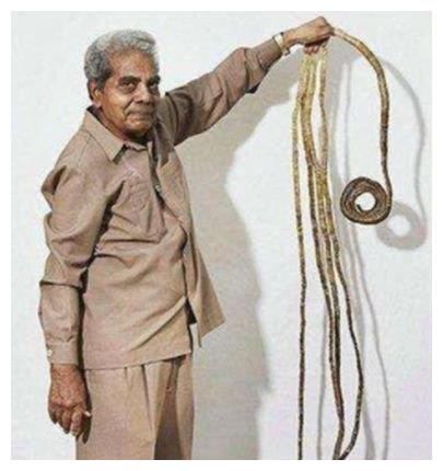 指甲剪|他剪掉66年指甲,将9米指甲捐博物馆后,他的手指发生新变化