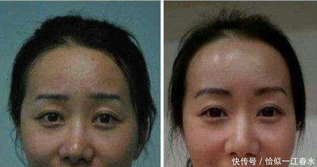 牙膏里添点“它”，敷脸一个月色斑消失不见，皮肤变得白皙又水润