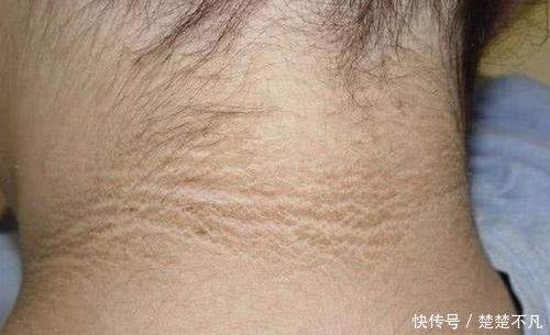 检查|6岁女儿脖颈发黑洗不掉,送医院检查,医生的解释令宝妈哭笑不得