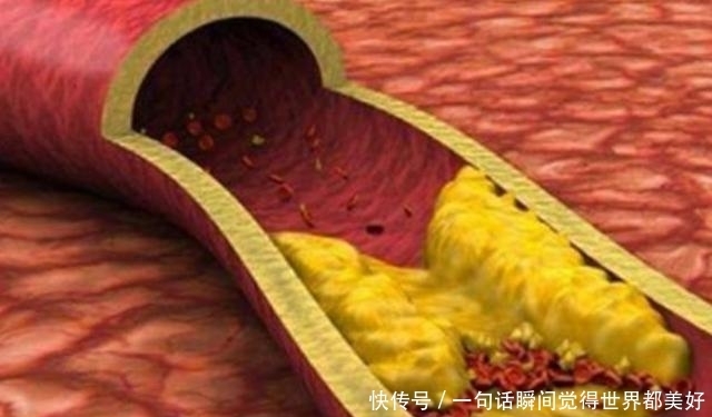 医生提醒：脑供血不足的人，平常多吃这3种蔬菜，或有助于缓解