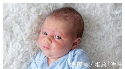 母乳|还在相信母乳过敏?不让孩子吃自己的奶才是因小失大