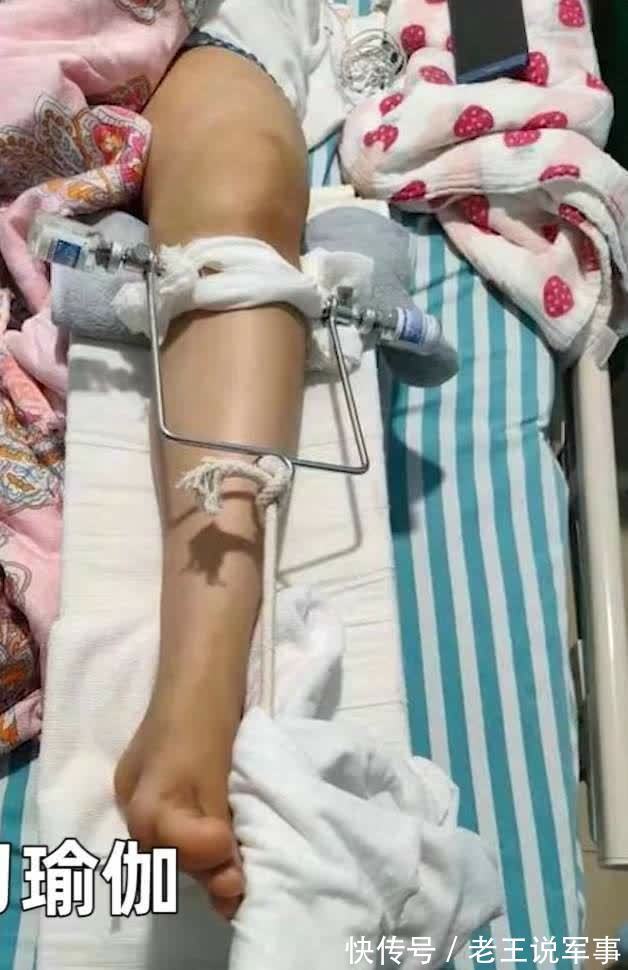 股骨干|女子第一次上私教课,练瑜伽被教练压断大腿!网友:下手太狠了!