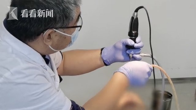 上颌窦|惊呆！男子鼻腔长了牙 医生：40年没见过这情况