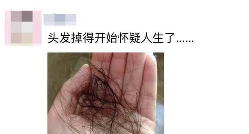 21岁女大学生脱发,惨遭谢顶,提醒:一种水少喝,不然早晚要光头