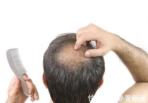 名医|养发先养血！清代名医王清任：一个方子，轻松搞定3年严重脱发