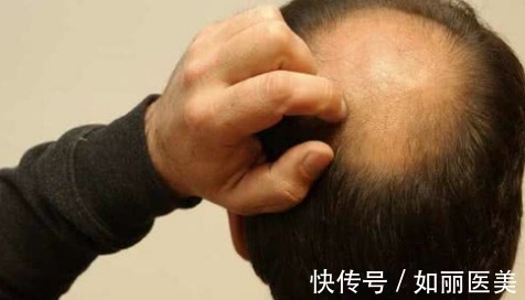 发际线 发际线种植术后原来需要这样护理!正确增加毛囊存活率