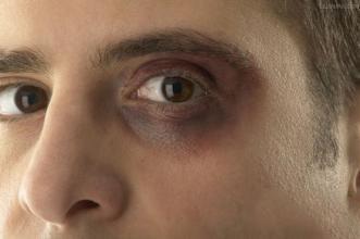 配方|一个化掉全身瘀血的经典配方,一凉一热,让你从头到脚不淤堵