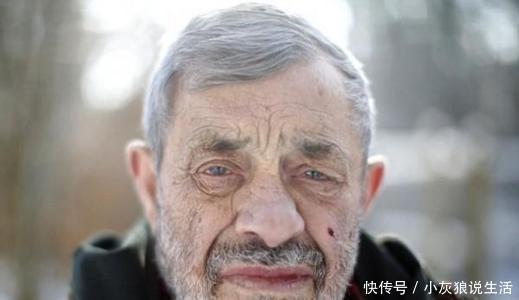 饮食习惯|老年痴呆的罪魁祸首发现了:这种食物吃得多,痴呆或会找上门来