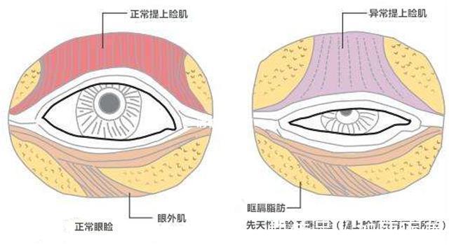 眼角 想让眼睛变大变美，可不只是一个简单的双眼皮手术就能改变的！