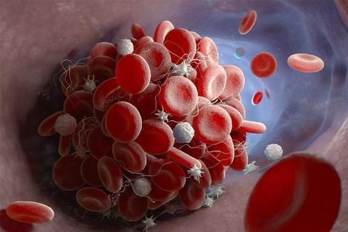 变现|血脂升高有哪些变现？若想降脂，学会这“1招”，或让血脂慢慢降