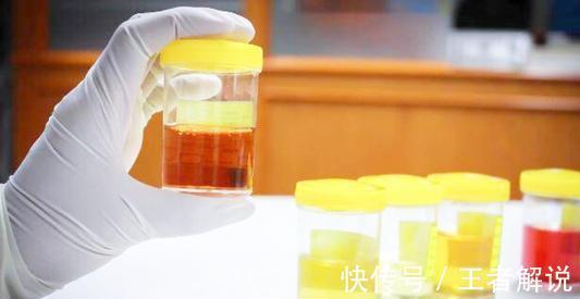 养肾|“三白”伤肾,建议少碰,“二红”养肾,不妨常吃,肾或给你点赞