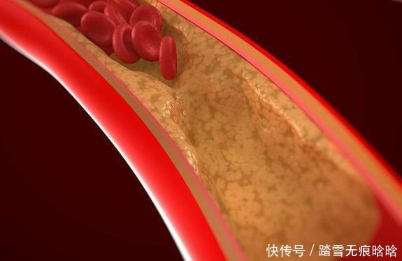 老王平时|内科主任提醒:喝水加1勺,连喝1个月,血管干净了,脑梗不敢犯