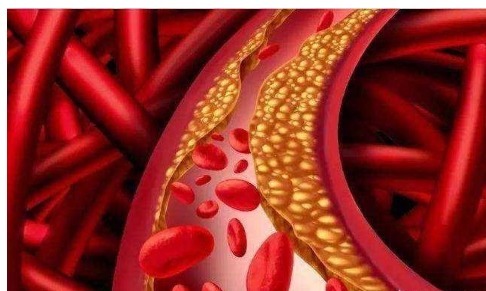 箭头|医生一步一步教您看血脂化验单，并不是有箭头就不正常！