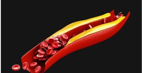 肝肾|一味中药坚持服用20天,就能把血脂降到正常