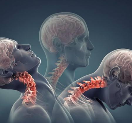 头晕|我的头晕到底是不是颈椎病引起的？脑科医生：大部分人可能都不是