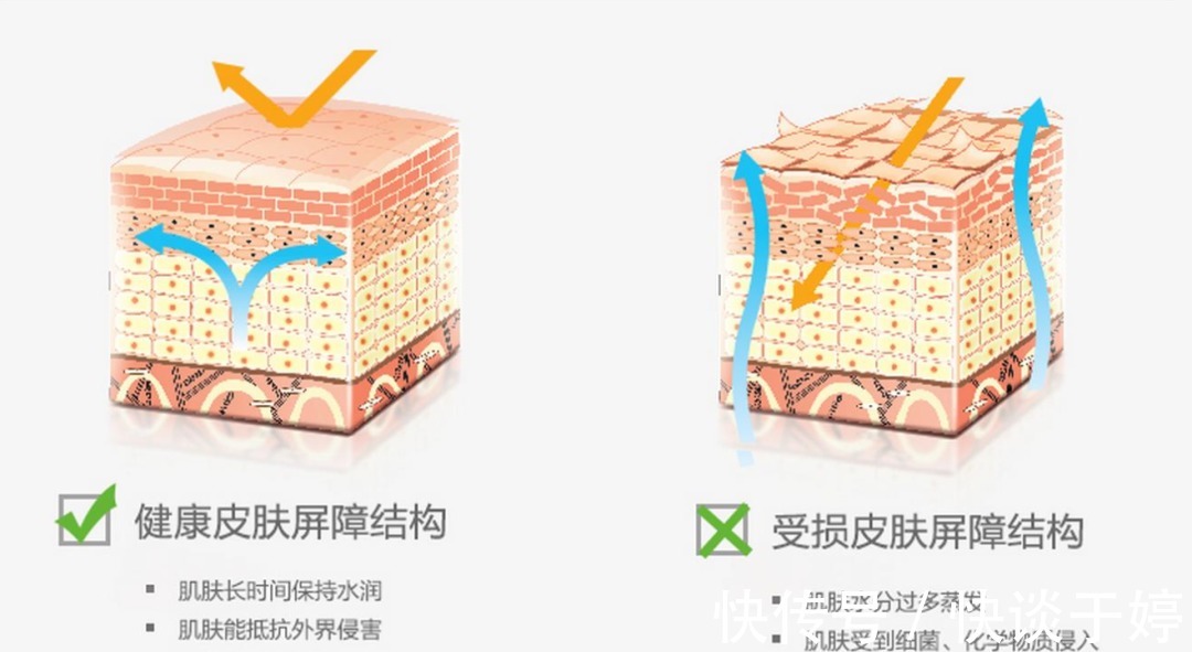 肌肤|肌肤屏障受损,多数因为护肤习惯差!