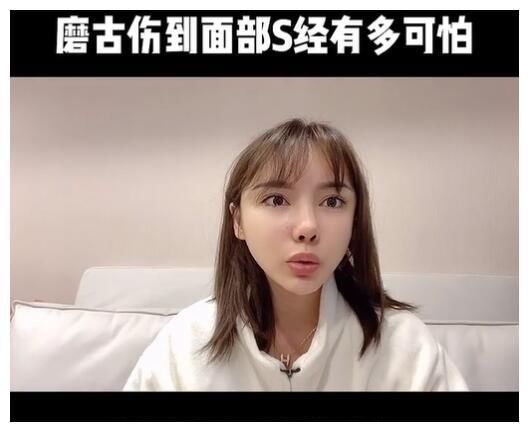 真实颜值|美女网红花70万却整形失败,磨骨伤到神经毁容,自叹非常后悔