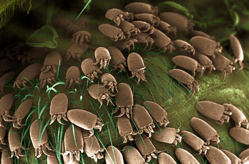 螨虫们|小小虫子不可轻视,过敏疾病的祸首就是它