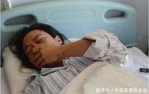 孩子|B超时胎儿“笑”得很灿烂,父母直夸宝宝可爱,医生:打掉孩子吧