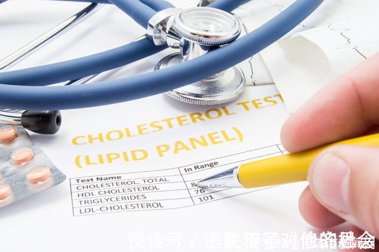 甘油三酯|平白无故出现3个症状,说明你的血脂很高了!不能再坐视不管