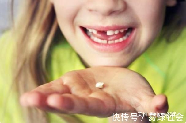 牙齿|孩子乳牙整齐漂亮，换牙后却越来越“歪”可能是这几点没做好