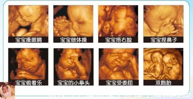 中期孕|除了睡觉，胎儿如何每天在肚子里都干啥宝宝小日子开心到飞起