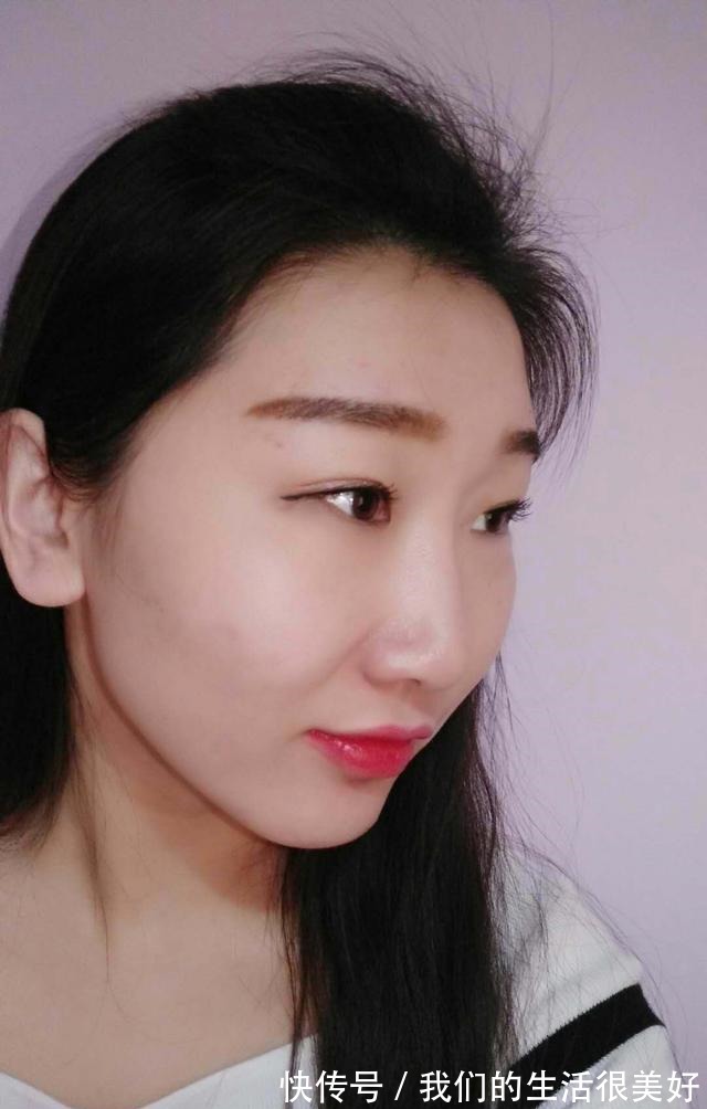 后感 M22光子嫩肤后感!