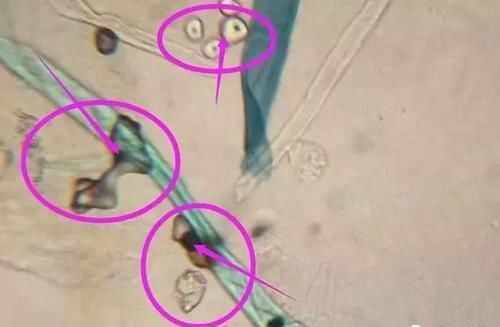 塑料袋|毛絮越扫越多？告诉你一个小妙招，轻松解决毛絮困扰