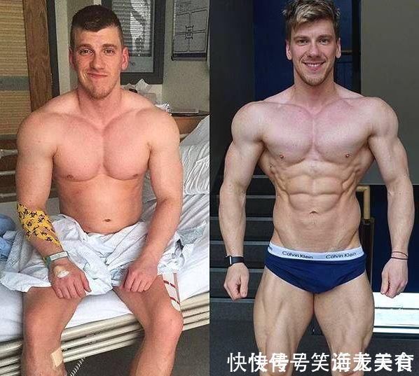 脂肪|26岁健美冠军,小腿突发意外,体脂太低是“原罪”