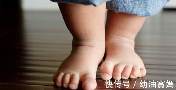 先天性髋关节脱位|宝宝出现这6个表现,及时去医院,耽误了可能导致长短腿一辈子!
