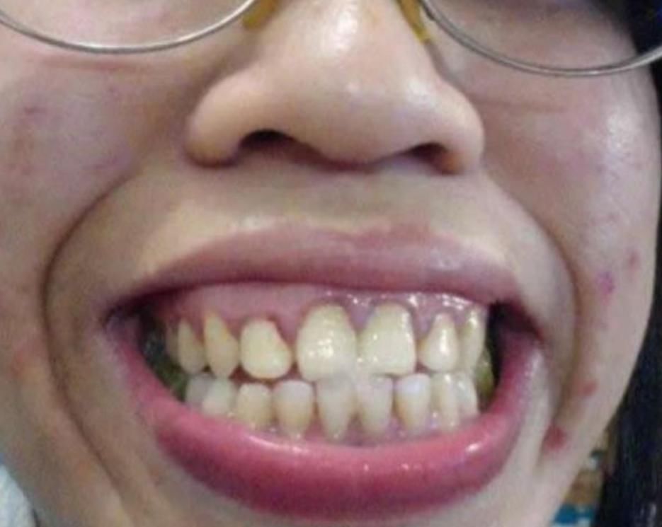 青春期最“糟蹋颜值”的3行为,05后别再盲目跟风,变丑可别哭鼻子