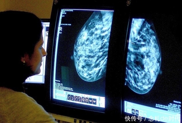 患者|一种提高晚期乳腺癌患者生存率的疗法：激素+瑞博西尼