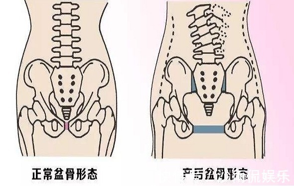 医生|女性生没生过孩子,身上有4个记号,医生一眼就能看出