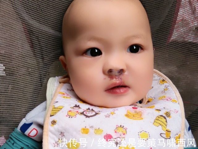 症状|宝宝若被“过度喂养”,多半会出现4个“症状”,家长别不当回事