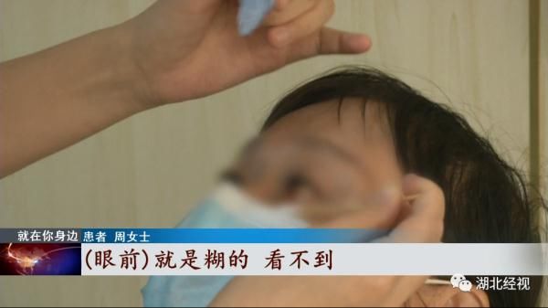 晶体|女子治疗脱发，眼睛晶体竟然脱落！只因这个操作