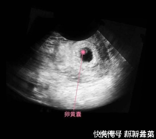 羊水|胎儿从卵泡到性别形成,17张图片清晰诠释,男宝女宝看得很清楚