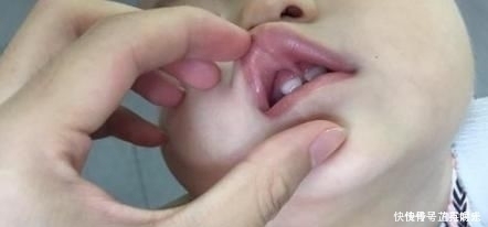 3岁男孩误食502胶水，妈妈下意识动作，获医生称赞平时没少读书