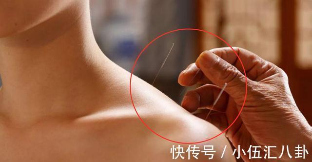 中医治疗|中医师:教你“3招”,助你好睡眠,总是凌晨三四点醒来,有救了