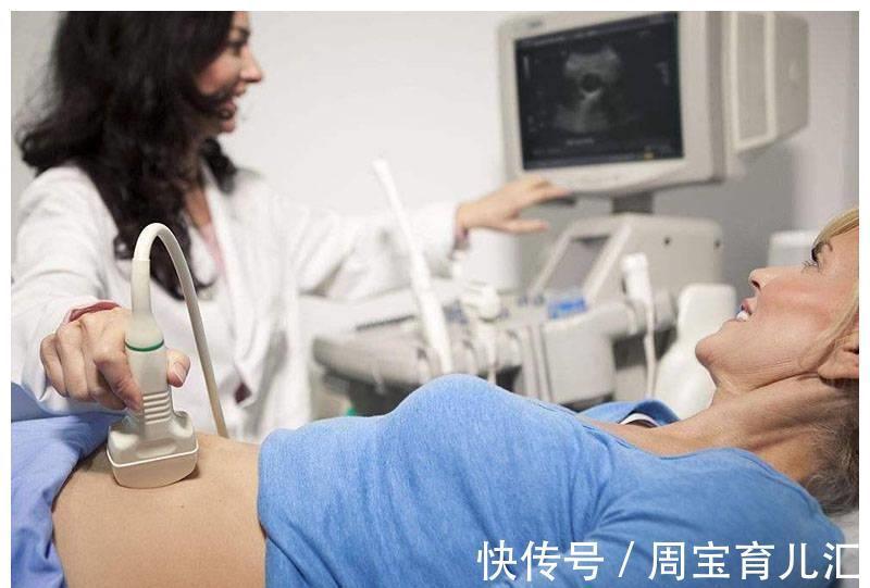 怀孕|怀孕3个月胎儿成形了吗?需要注意哪些问题?