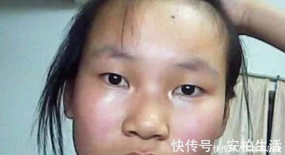 哑光美人|青春期女孩总是“油光满面”？坚持3小事，从此做个“哑光美人”