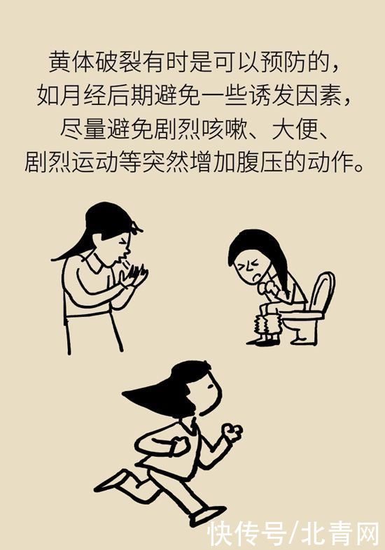 腹痛|这种腹痛常被误认宫外孕，背后诱因要牢记