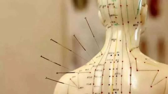 意外|阿婆自行针灸出意外，5厘米断针留在腹中