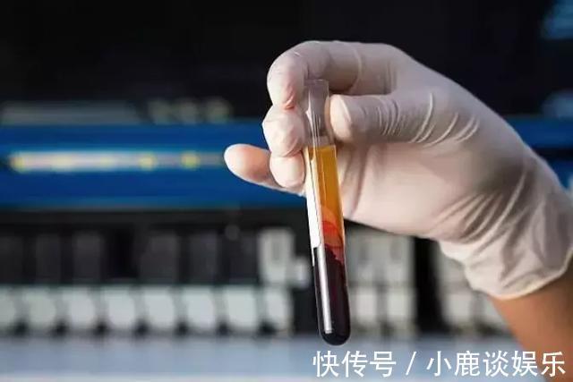 甘油三酯|高血脂的天然“死对头”!每天吃一点,稳定三高、健康全身