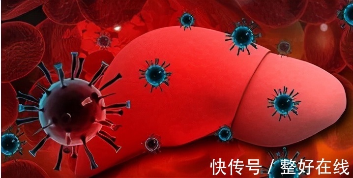 治疗|从乙肝到肝硬化到底需要多久?专家提醒:4种方法可预防肝硬化