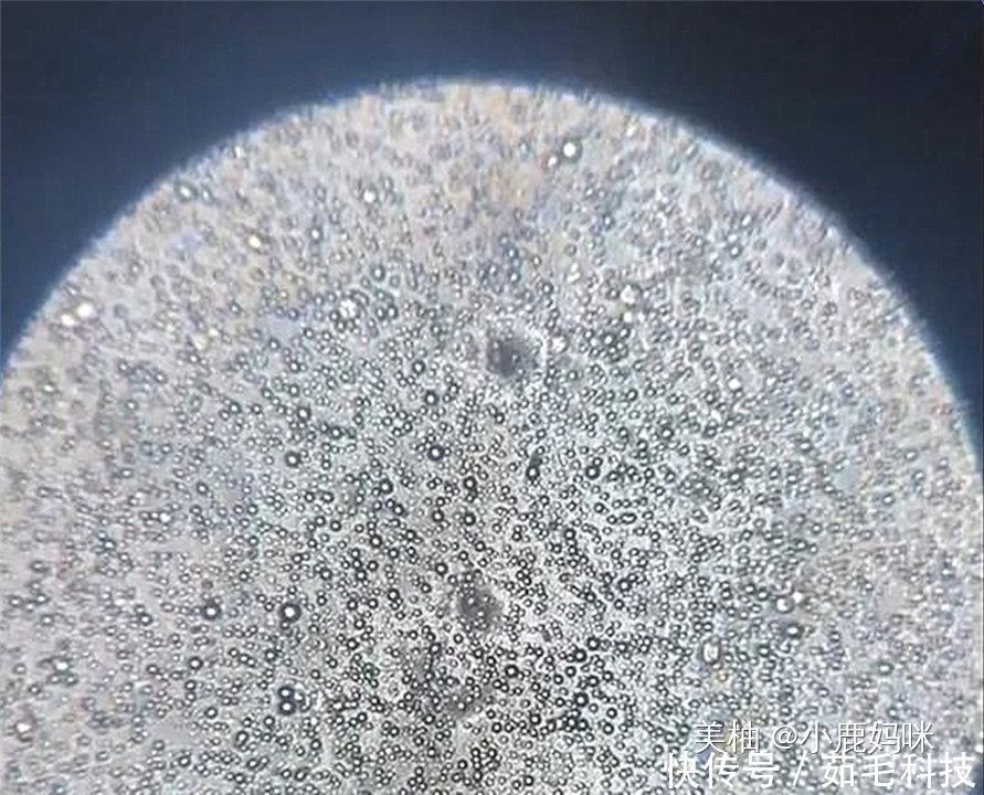 添加剂|将母乳放大1000倍是什么样显微镜下的图片,当妈的都该看看
