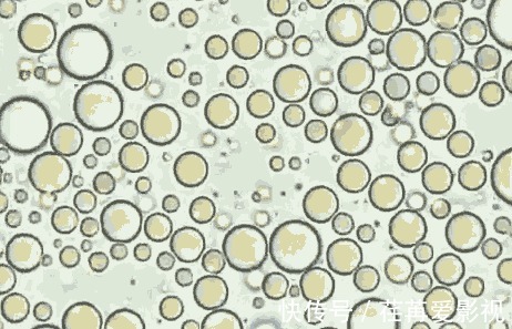 母乳喂养|把母乳放在显微镜下,竟然是“活的”,会微微蠕动