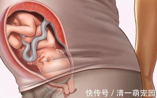 污染|孕期做到“4不碰”,有利于保持羊水“清澈”,胎儿住着更干净