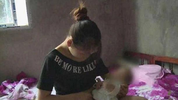 大花脸|产后抑郁多可怕?妈妈用剪刀把孩子划成“大花脸”,现恢复得很好