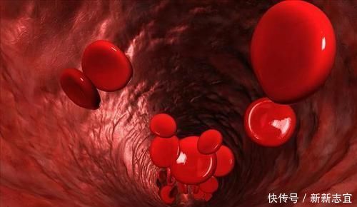 血管|大病到来,“脚”先知,脚上出现4种表现,抓紧就医,莫再拖